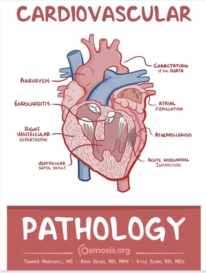 Cardiovascular Pathology Osmosis