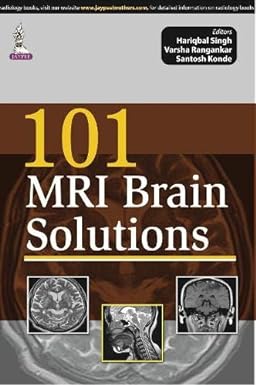 101 MRI Brain Solutions 1st Edition