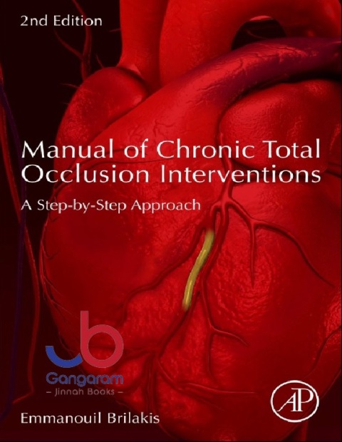 Manual of Chronic Total Occlusion Interventions: A Step-by-Step Approach 2nd Edition