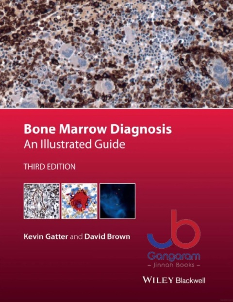 Bone Marrow Diagnosis: An Illustrated Guide 3rd Edition