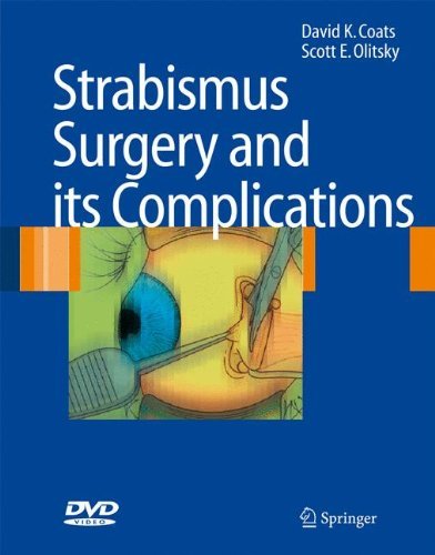Strabismus Surgery and its Complications 2007th Edition