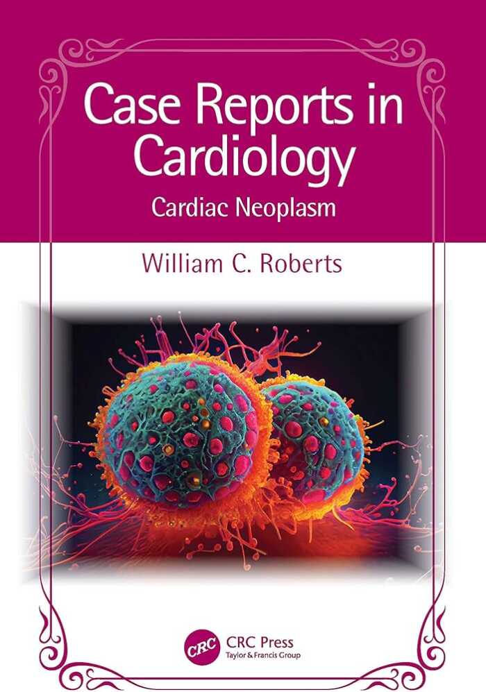 Case Reports in Cardiology Cardiac Neoplasm