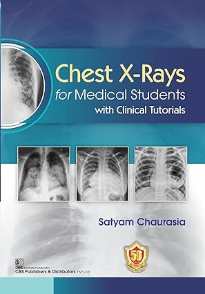 Chest X-Rays for Medical Students with Clinical Tutorials