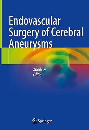 Endovascular Surgery of Cerebral Aneurysms 1st ed