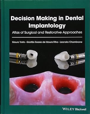 Decision Making in Dental Implantology: Atlas of Surgical and Restorative Approaches 1st Edition