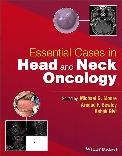 Essential Head and Neck Oncology and Surgery