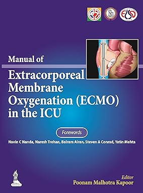 Manual of Extracorporeal Membrane Oxygenation (Ecmo) in the ICU 1st Edition