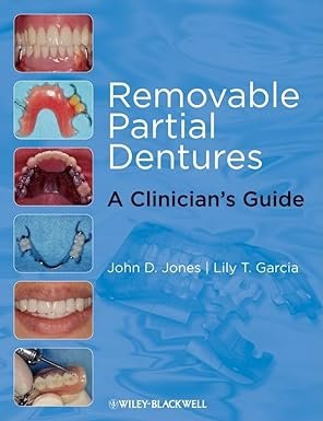 Removable Partial Dentures: A Clinician's Guide 1st Edition