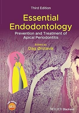 Essential Endodontology: Prevention and Treatment of Apical Periodontitis 3rd Edition