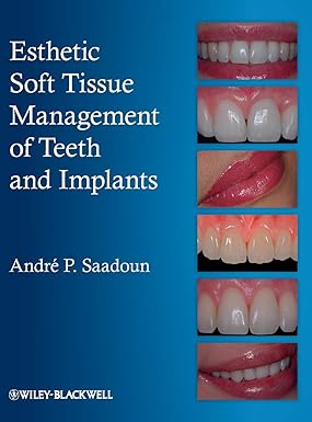 Esthetic Soft Tissue Management of Teeth and Implants 1st Edition