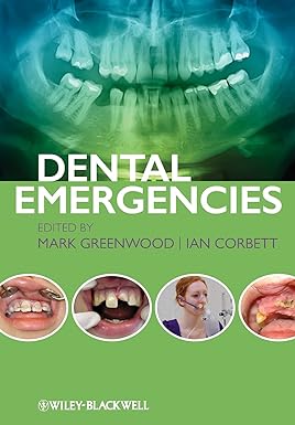 Dental Emergencies 1st Edition