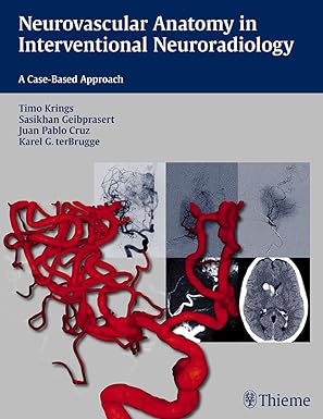 Neurovascular Anatomy in Interventional Neuroradiology: A Case-Based Approach 1st Edition