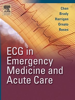 ECG in Emergency Medicine and Acute Care 1st Edition