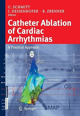 Catheter Ablation of Cardiac Arrhythmias: A Practical Approach