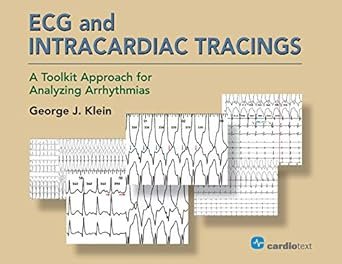 ECG and Intracardiac Tracings: A Toolkit Approach for Analyzing Arrhythmias
