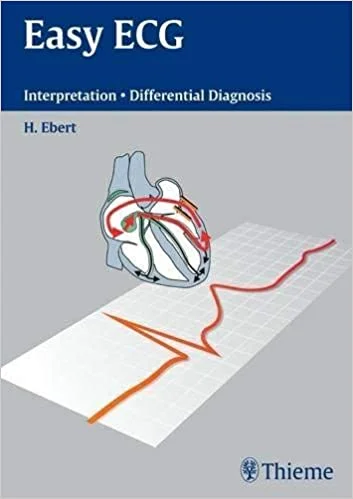 Easy ECG: Interpretation Differential Diagnoses 1st Edition