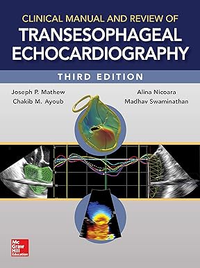 Clinical Manual and Review of Transesophageal Echocardiography, 3/e 3rd Edition