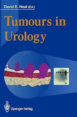Tumours in Urology
