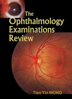 The Ophthalmology Examinations Review 1st Edition