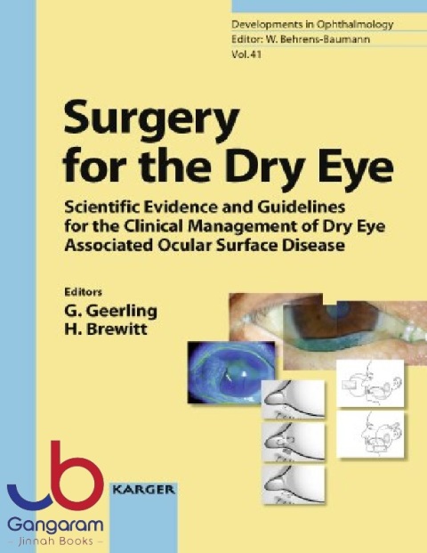 Surgery for the Dry Eye: Scientific Evidence and Guidelines for the Clinical Management of Dry Eye Associated with Ocular Surface Disease (Developments in Ophthalmology)