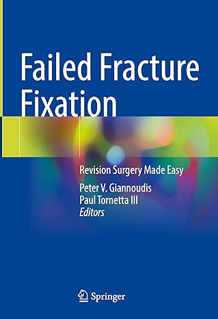 Failed Fracture Fixation: Revision Surgery Made Easy 1st ed