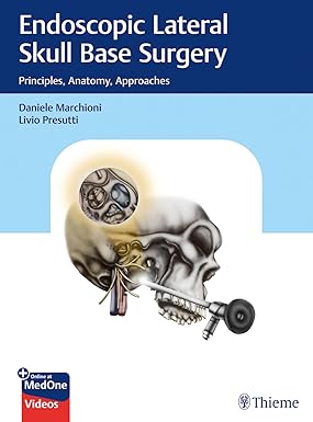 Endoscopic Lateral Skull Base Surgery: Principles, Anatomy, Approaches 1st Edition