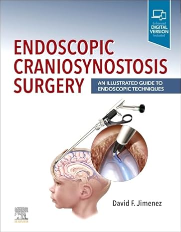 Endoscopic Craniosynostosis Surgery: An Illustrated Guide to Endoscopic Techniques 1st Edition