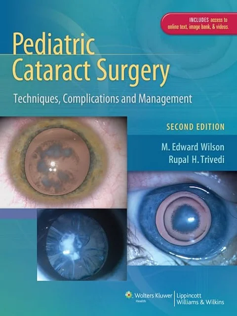 Pediatric Cataract Surgery: Techniques, Complications and Management 2nd Edition