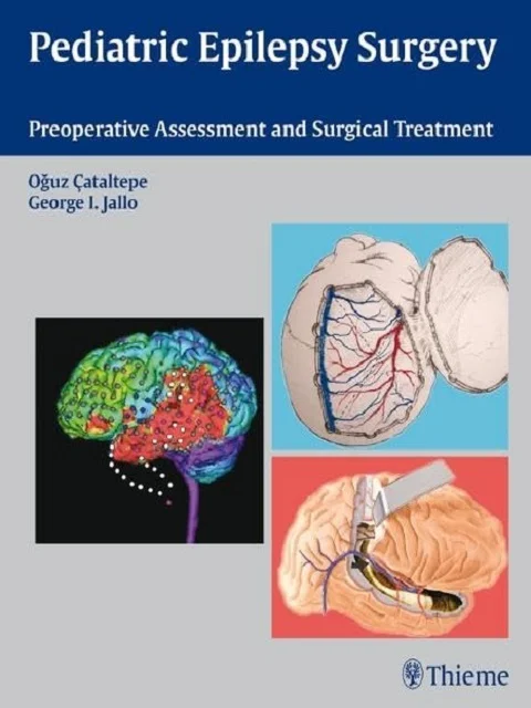 Pediatric Epilepsy Surgery: Preoperative Assessment and Surgical Treatment 1st Edition