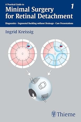 A Practical Guide to Minimal Surgery for Retinal Detachment, Volume 1: Diagnostics, Segmental Buckling Without Drainage, Case Presentations