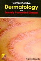 Comprehensive Dermatology And Sexually Transmitted Diseases
