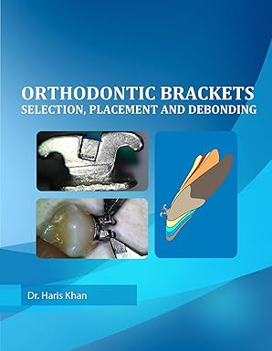 ORTHODONTIC BRACKETS: SELECTION, PLACEMENT AND DEBONDING