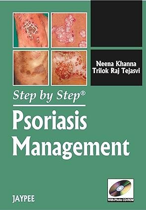 Psoriasis Management (Step by Step) 1st Edition