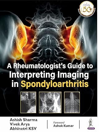 A RHEUMATOLOGIST’S GUIDE TO INTERPRETING IMAGING IN SPONDYLOARTHRITIS