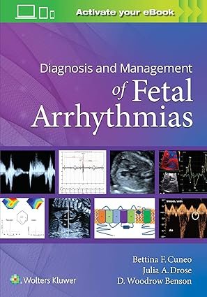 Diagnosis and Management of Fetal Arrhythmias