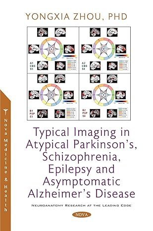 Typical Imaging in Atypical Parkinson’s, Schizophrenia, Epilepsy and Asymptomatic Alzheimer’s Disease