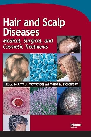 Hair and Scalp Diseases: Medical, Surgical, and Cosmetic Treatments 1st Edition