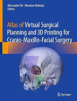 Atlas of Virtual Surgical Planning and 3D Printing for Cranio-Maxillo-Facial Surgery