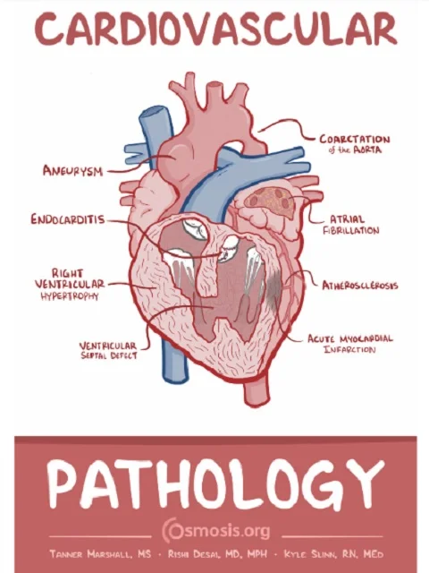 Cardiovascular – Pathology