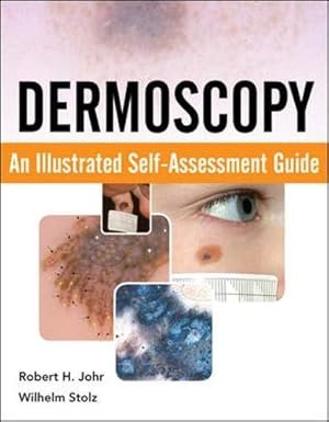Dermoscopy: An Illustrated Self-Assessment Guide 1st Edition