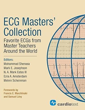 ECG Masters Collection: Favorite ECGs from Around the World 1st Edition