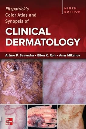 Fitzpatrick's Color Atlas and Synopsis of Clinical Dermatology 9th Edition