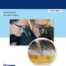Hair Transplantation 6th Edition