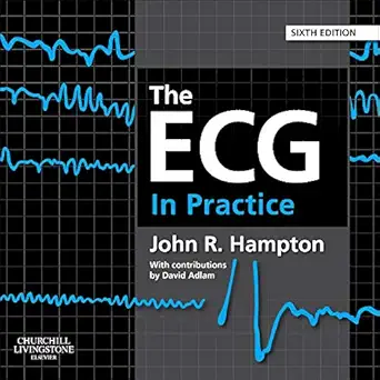 The ECG In Practice 6th Edition